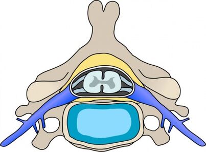 nyaki osteochondrozis hormonális gyógyszerei